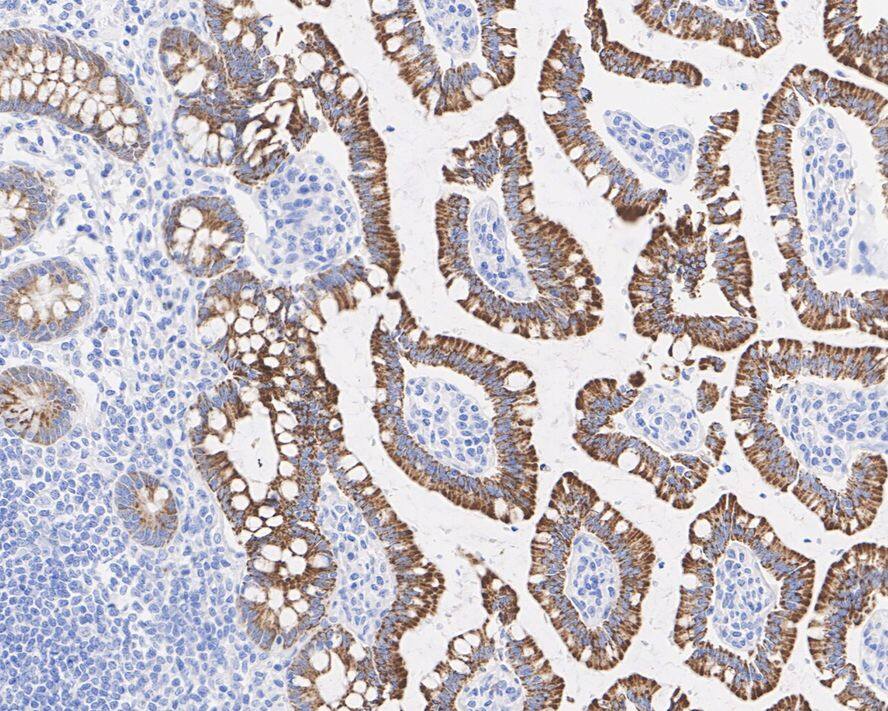 PGR1 Antibody (PSH02-12)