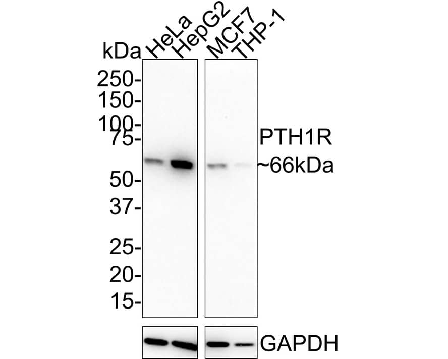 PTH1R/PTHR1 Antibody (JE36-10)