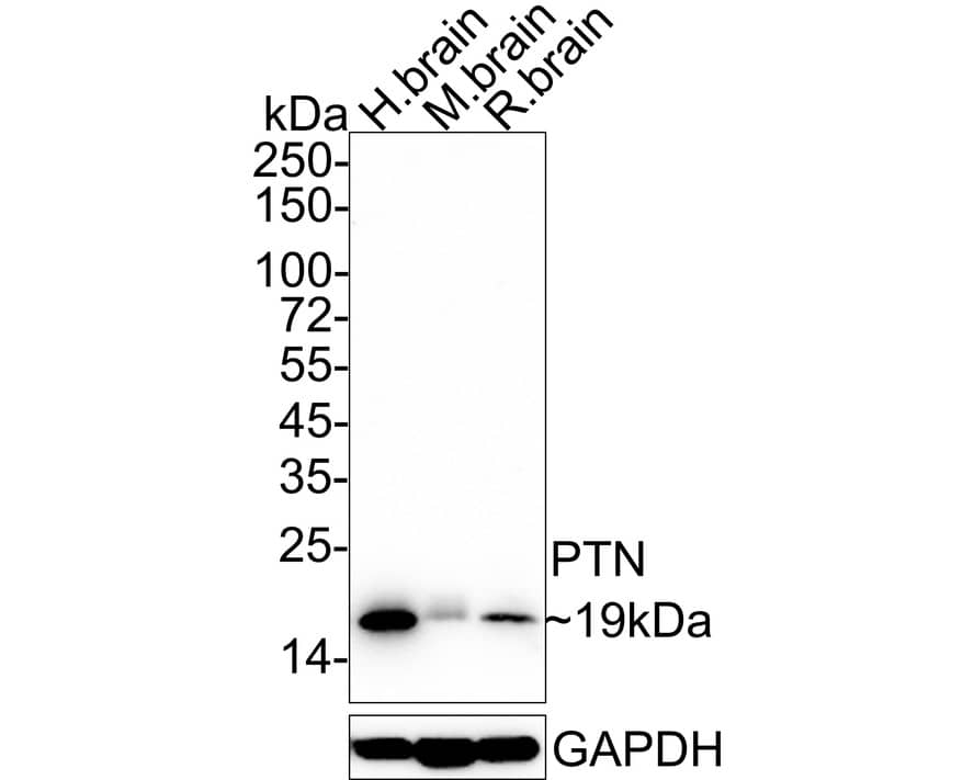 Pleiotrophin/PTN Antibody (JE47-40)