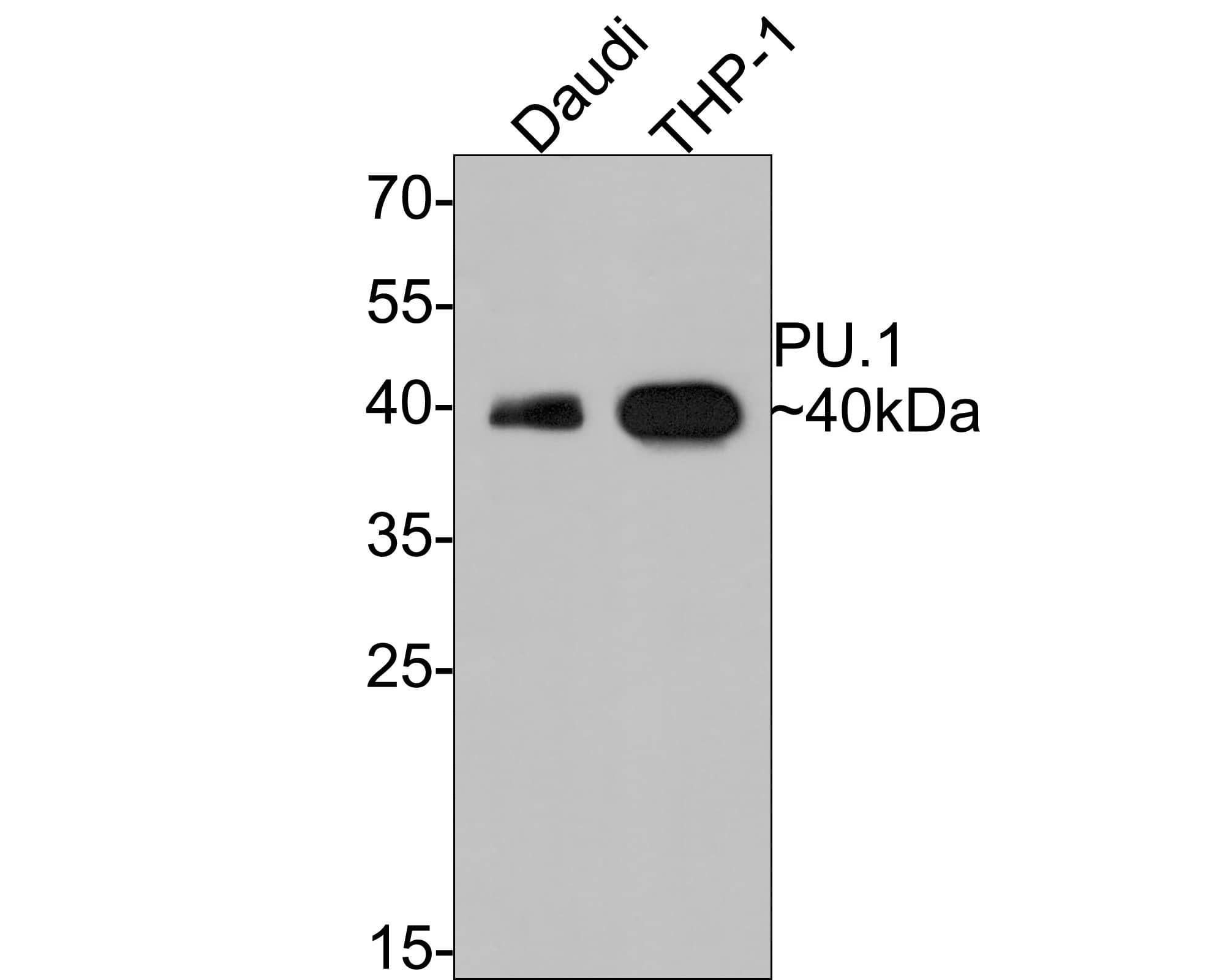 PU.1/Spi-1 Antibody (PD00-14)