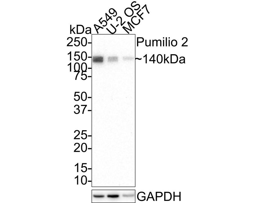 PUM2 Antibody (JE37-76)