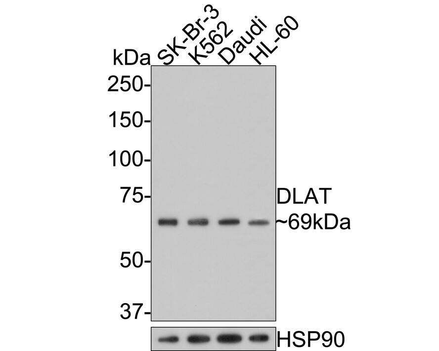 Pyruvate Dehydrogenase E2 Antibody (JE34-38)