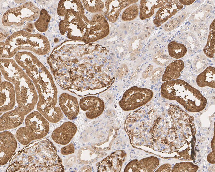 QPRT Antibody (PSH01-31)