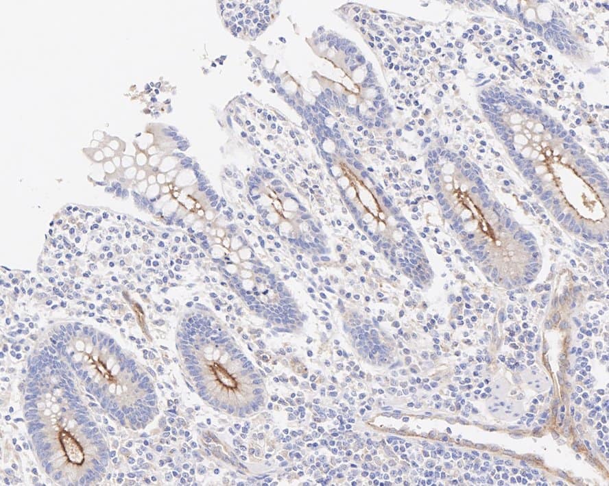 Rab11A Antibody (JE42-00)
