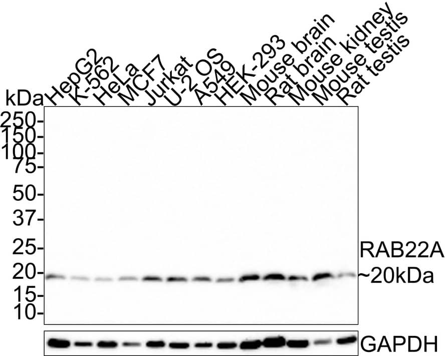 RAB22A Antibody (JE66-08)