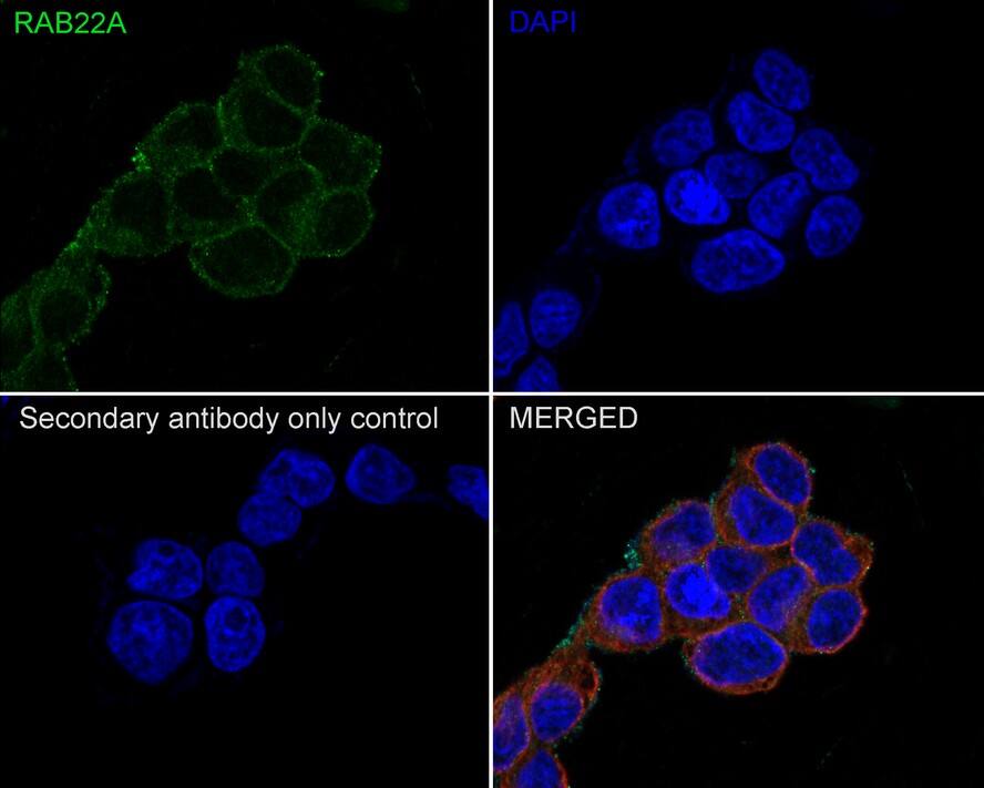 RAB22A Antibody (JE66-08)