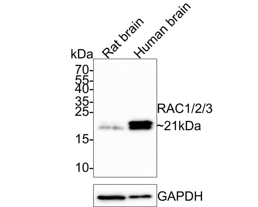 Rac1,2,3 Antibody