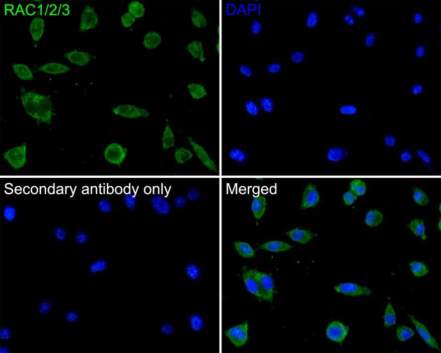 Rac1,2,3 Antibody
