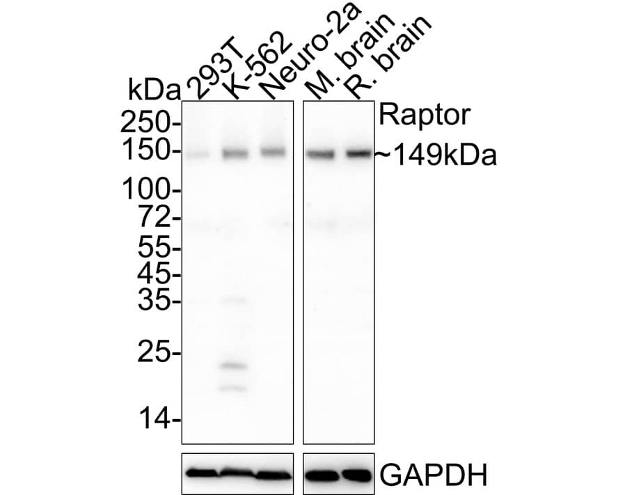 RPTOR Antibody (JE59-39)