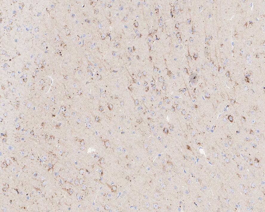 RPTOR Antibody (JE59-39)