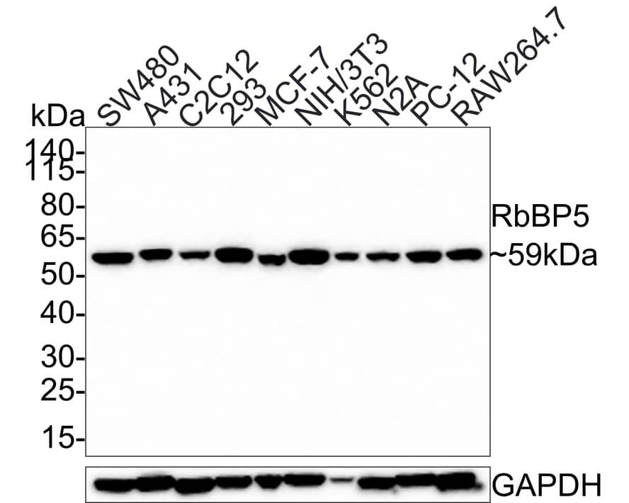 RbBP5 Antibody (PSH0-15)