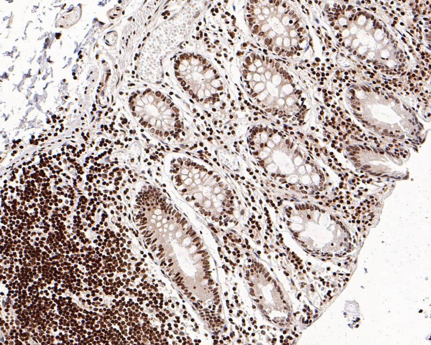 RbBP5 Antibody (PSH0-16)