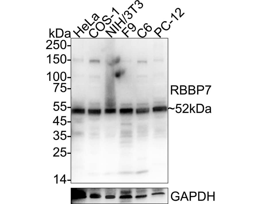 RbAp46 Antibody Western Blot: RbAp46 Antibody [NBP3-32897]