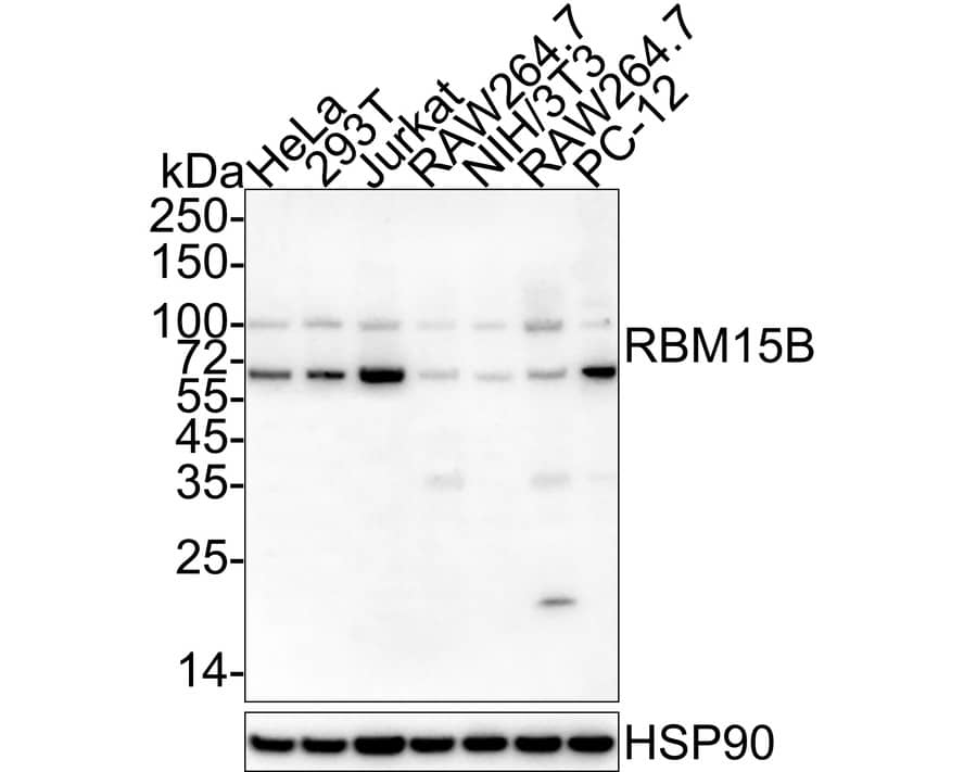 RBM15B Antibody (A10D12+A10D11)