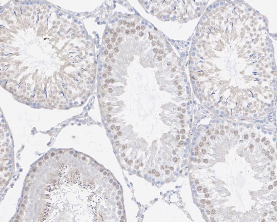 WHSC1 Antibody (PSH02-39)
