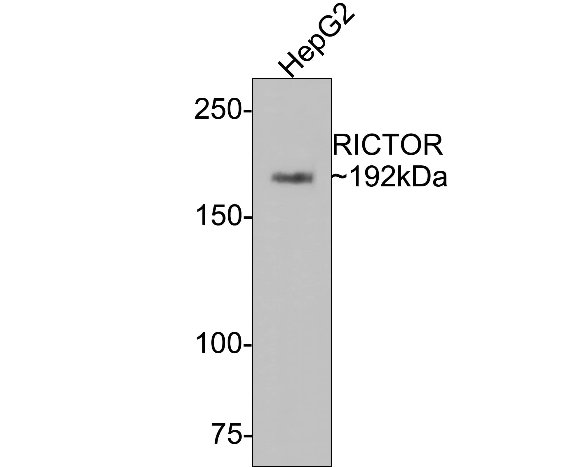 Rictor Antibody (1A5)