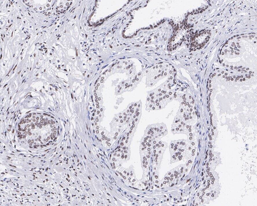 RING1 Antibody (JE34-66)