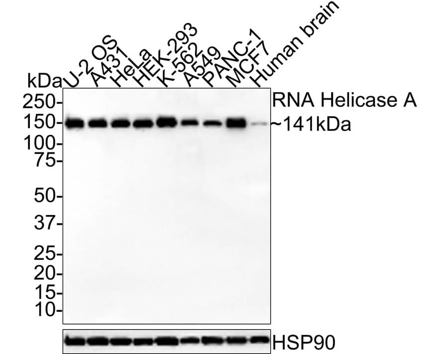 RNA Helicase A Antibody (JE34-97)