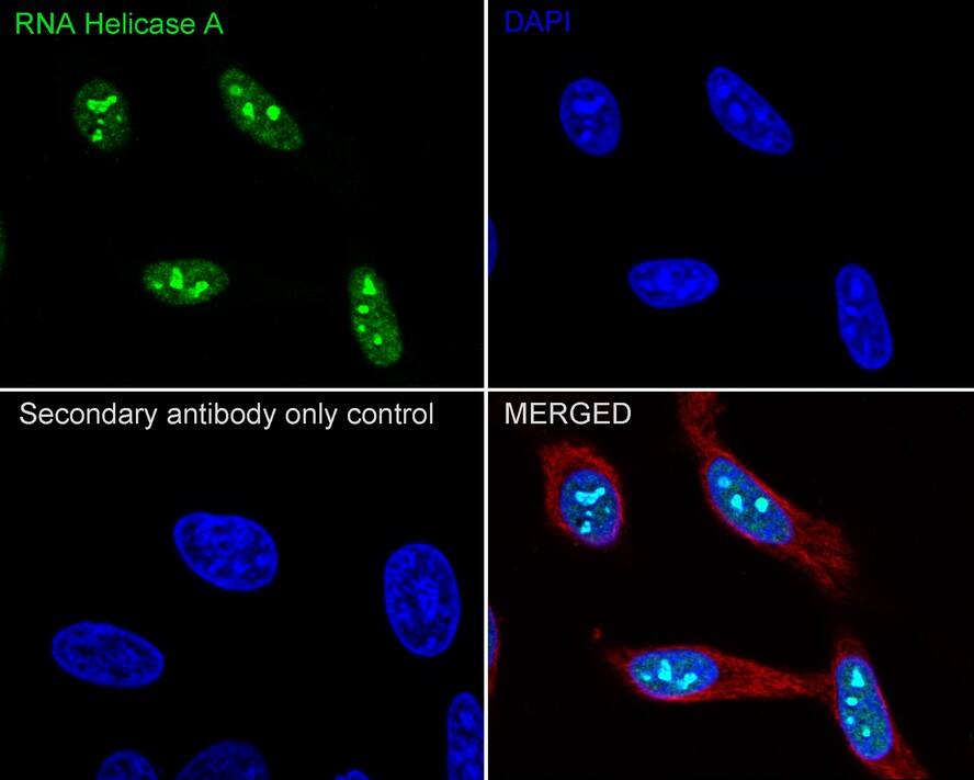 RNA Helicase A Antibody (JE34-97)