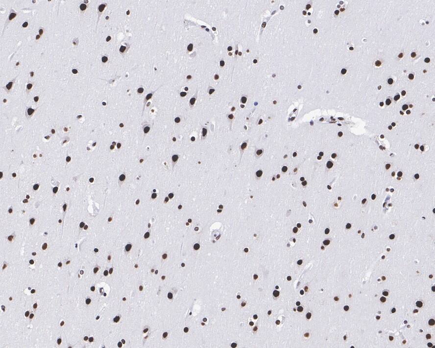 RNA Helicase A Antibody (JE34-97)