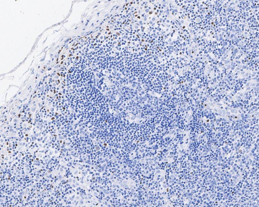 T-bet/TBX21 Antibody (JE60-20)