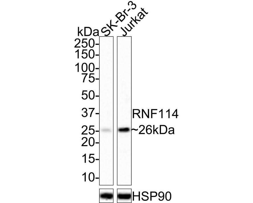 RNF114 Antibody (PSH01-99)