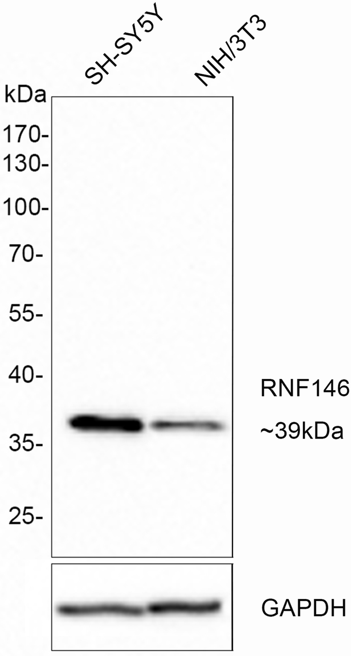 RNF146 Antibody (PSH0-29)