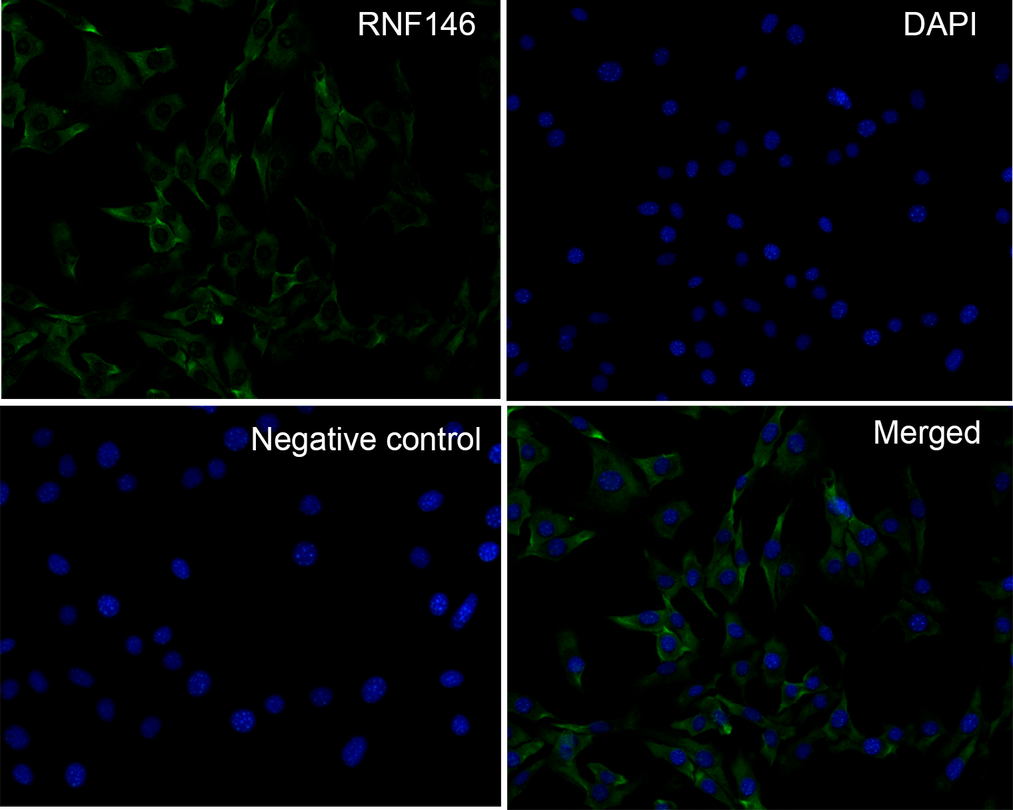RNF146 Antibody (PSH0-29)