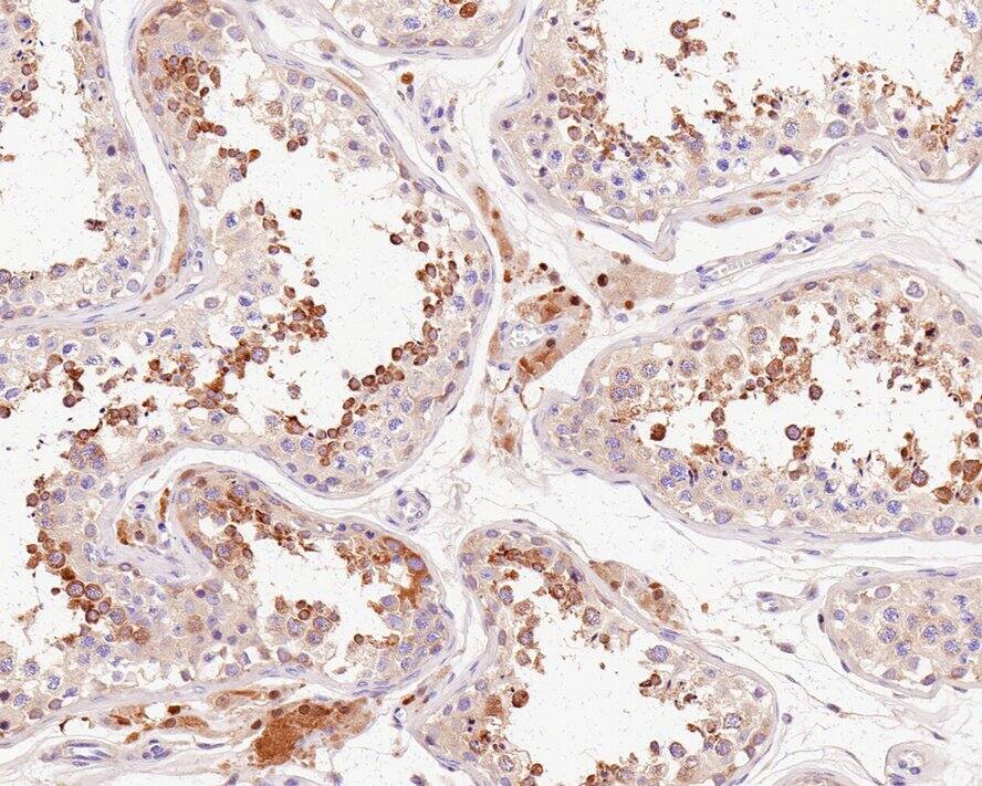 RNF146 Antibody (PSH0-29)