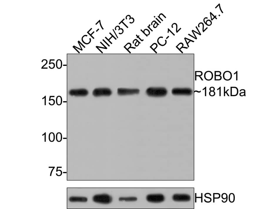 ROBO1 Antibody (10E2-R)