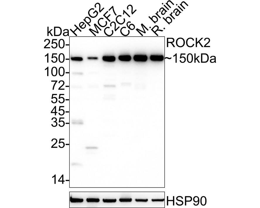 ROCK2 Antibody (JE31-36)