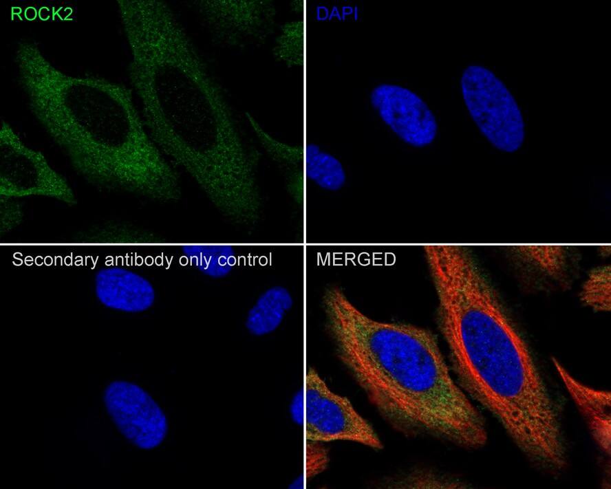 ROCK2 Antibody (JE31-36)