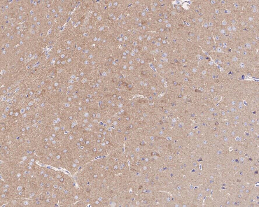 ROCK2 Antibody (JE31-36)