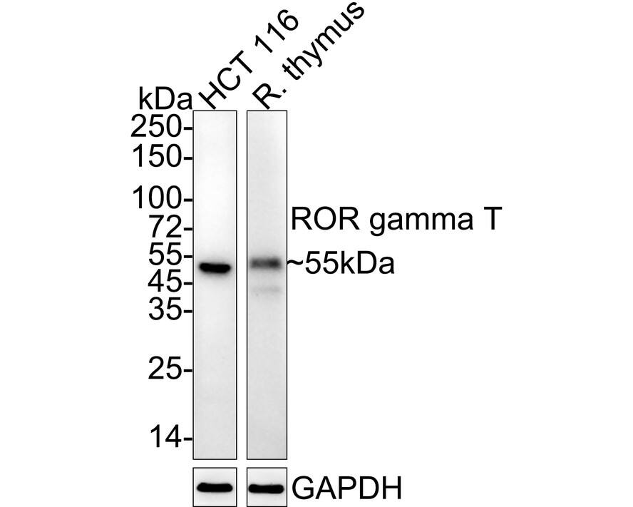 ROR gamma t/RORC2/NR1F3 Antibody (PSH04-38) Western Blot: ROR gamma t/RORC2/NR1F3 Antibody (PSH04-38) [NBP3-32915]