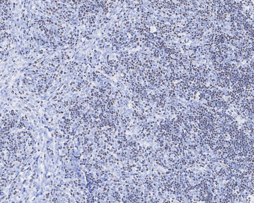 ROR gamma t/RORC2/NR1F3 Antibody (PSH04-38)