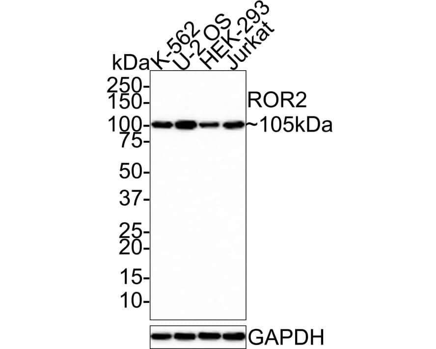 ROR2 Antibody (JE37-72)