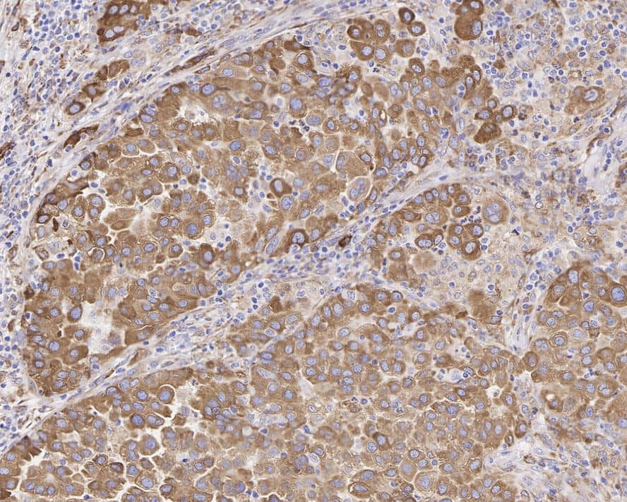 ROS Antibody (PD01-27)