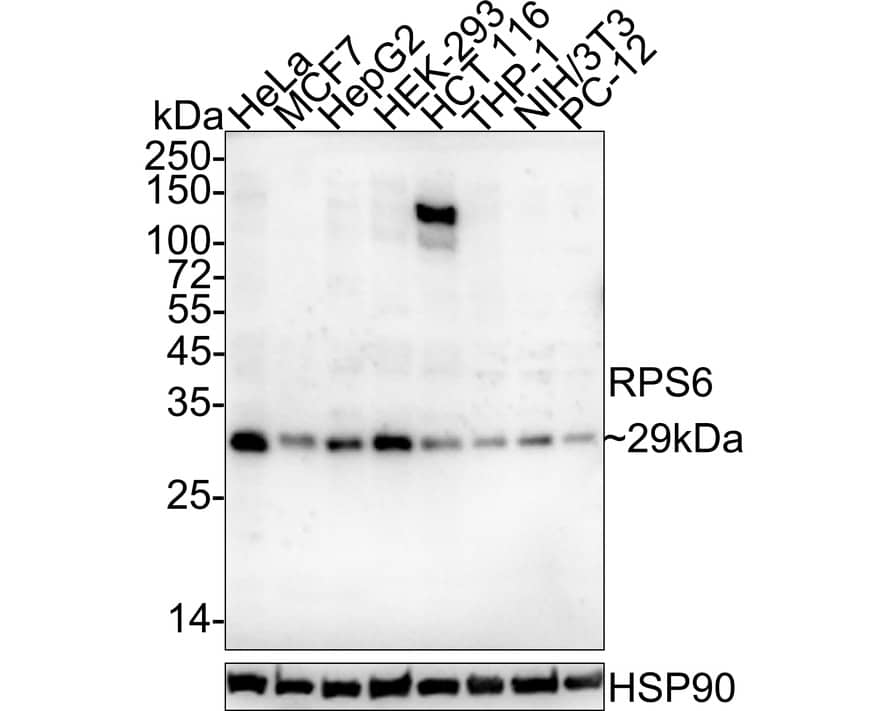 Ribosomal Protein S6/RPS6 Antibody (A6B8-R)