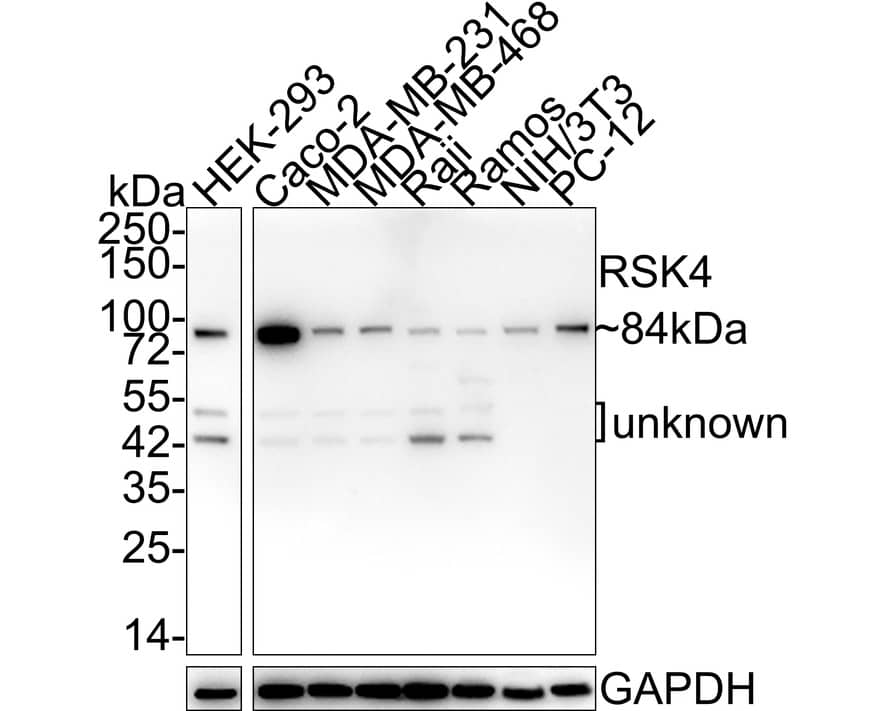 RSK4 Antibody (PSH02-04)