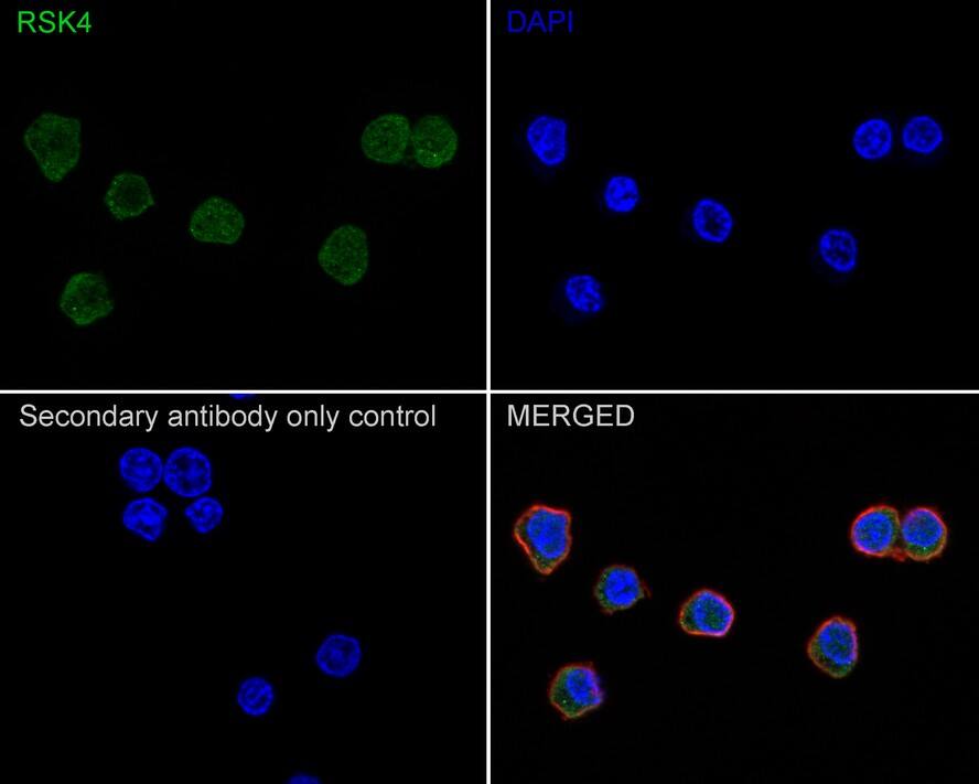 RSK4 Antibody (PSH02-04)