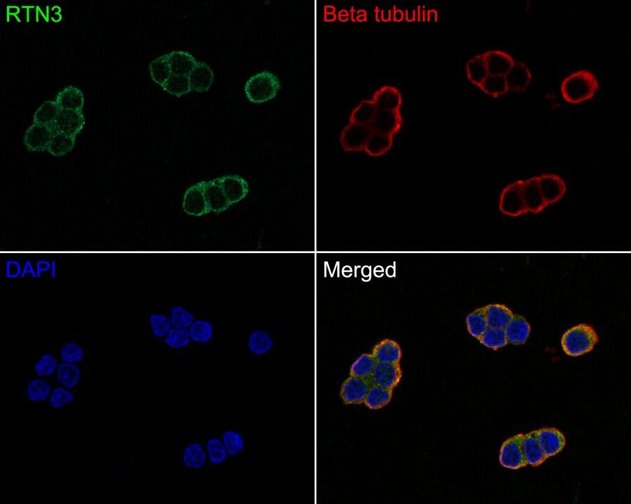 RTN3 Antibody (PSH0-40)