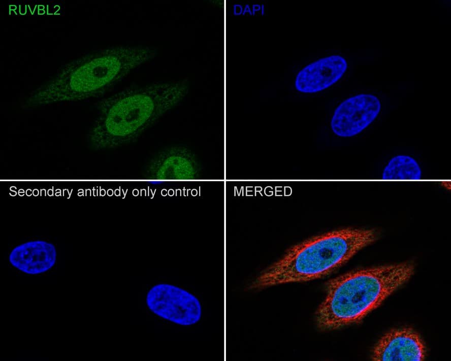 RUVBL2 Antibody (A1E12-R)