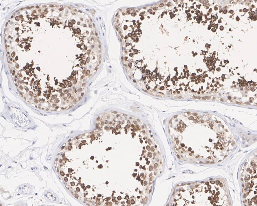 RUVBL2 Antibody (A1E12-R)