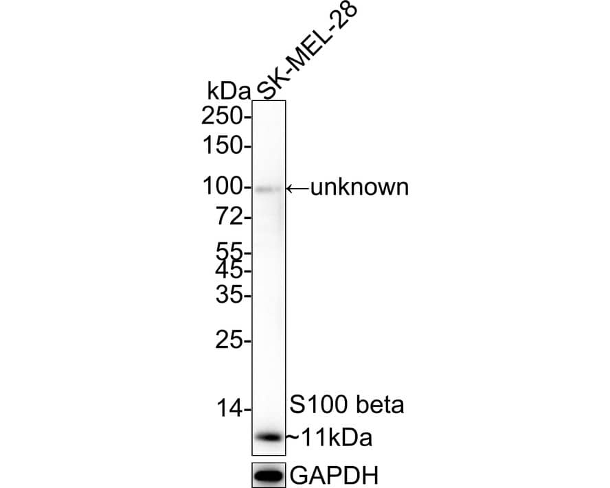 S100B Antibody (PD00-11)