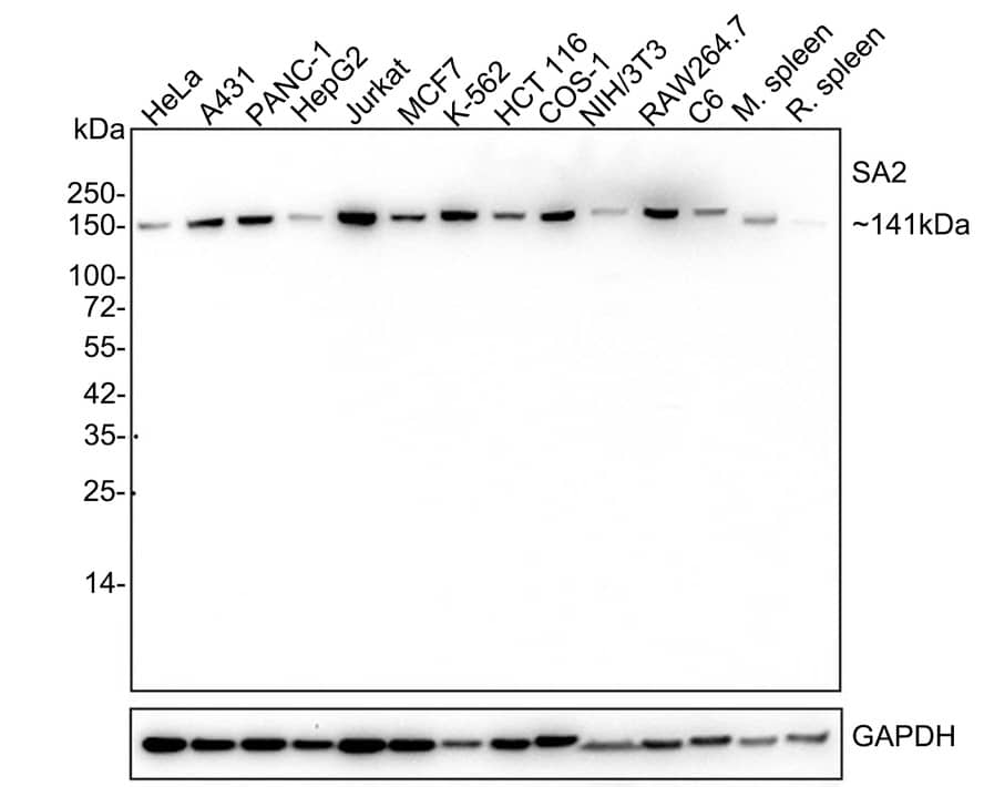 STAG2 Antibody (JE57-34)