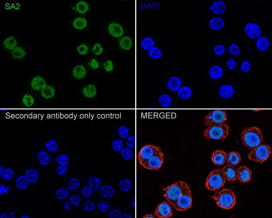 STAG2 Antibody (JE57-34)