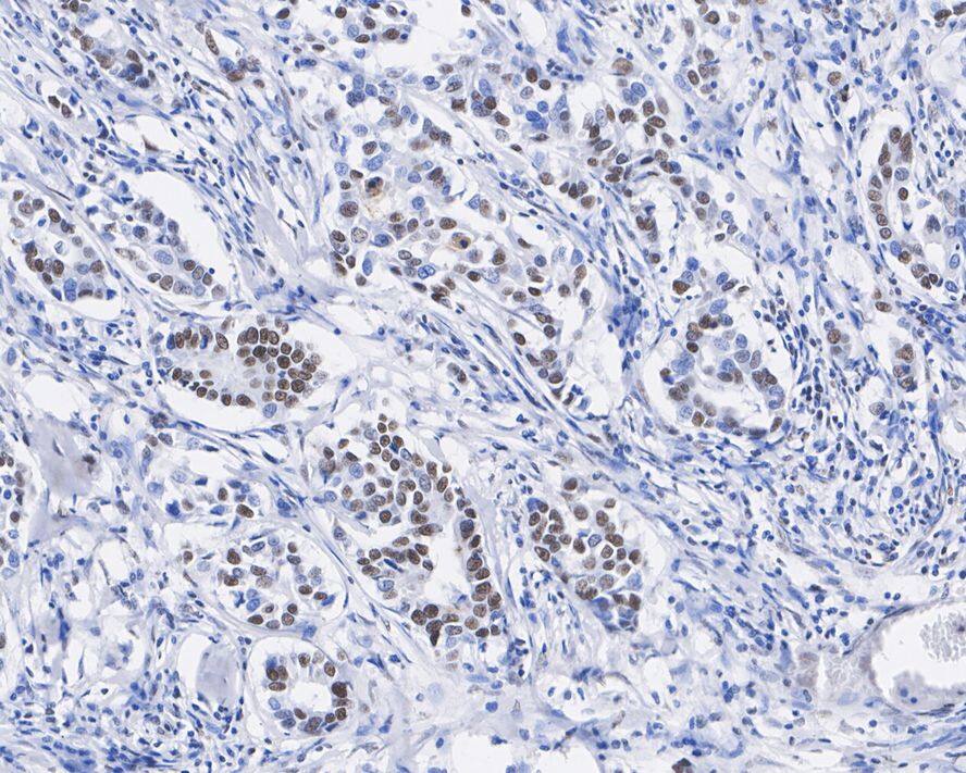 STAG2 Antibody (JE57-34)