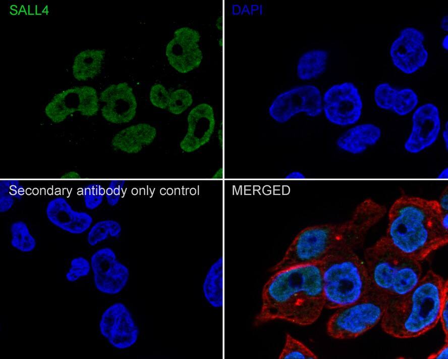 SALL4 Antibody (A9G9-R)