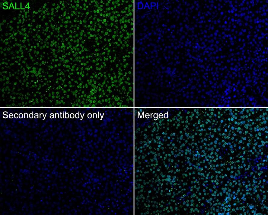 SALL4 Antibody (A9G9-R)