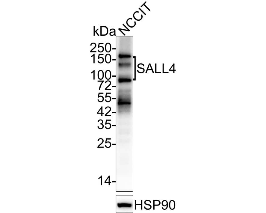 SALL4 Antibody (A7A7-R)